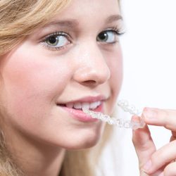 Bambina con apparecchio invisibile per i denti