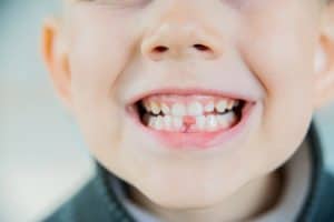 Un bambino con i denti da latte