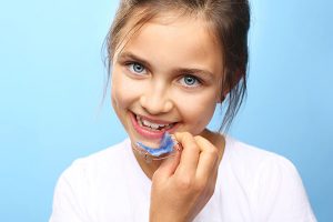 Dental House Kids | Apparecchio linguale
